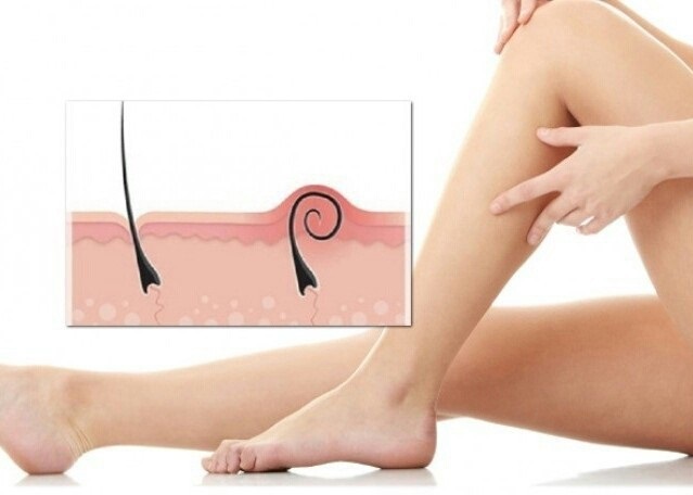 cum se tratează articulația genunchilor